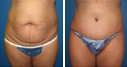 Before & After Photos